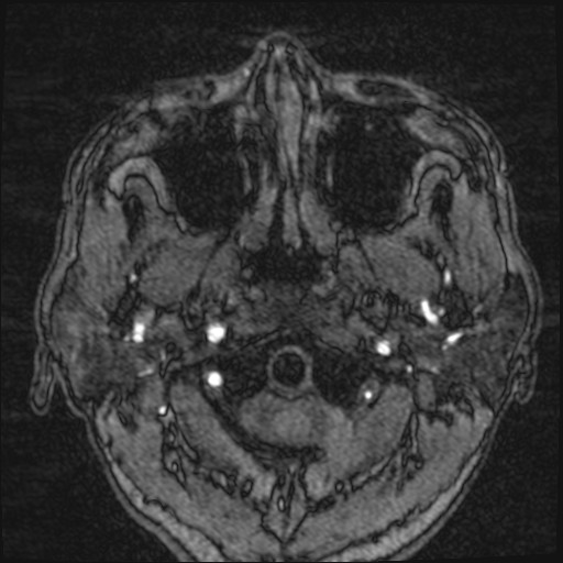 Click on the Serie image to view the images of VILLANUEVA, WILLIAM A.